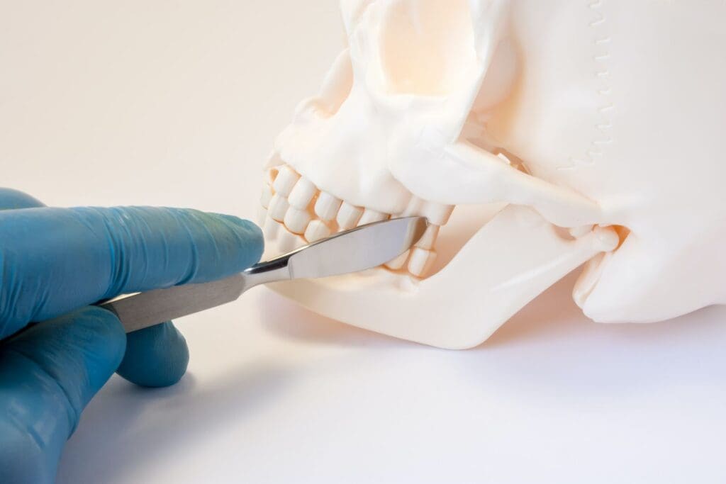 Tooth Extraction in Reno, NV