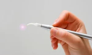 How Laser Dentistry Makes Gum Procedures Easier in Reno, NV